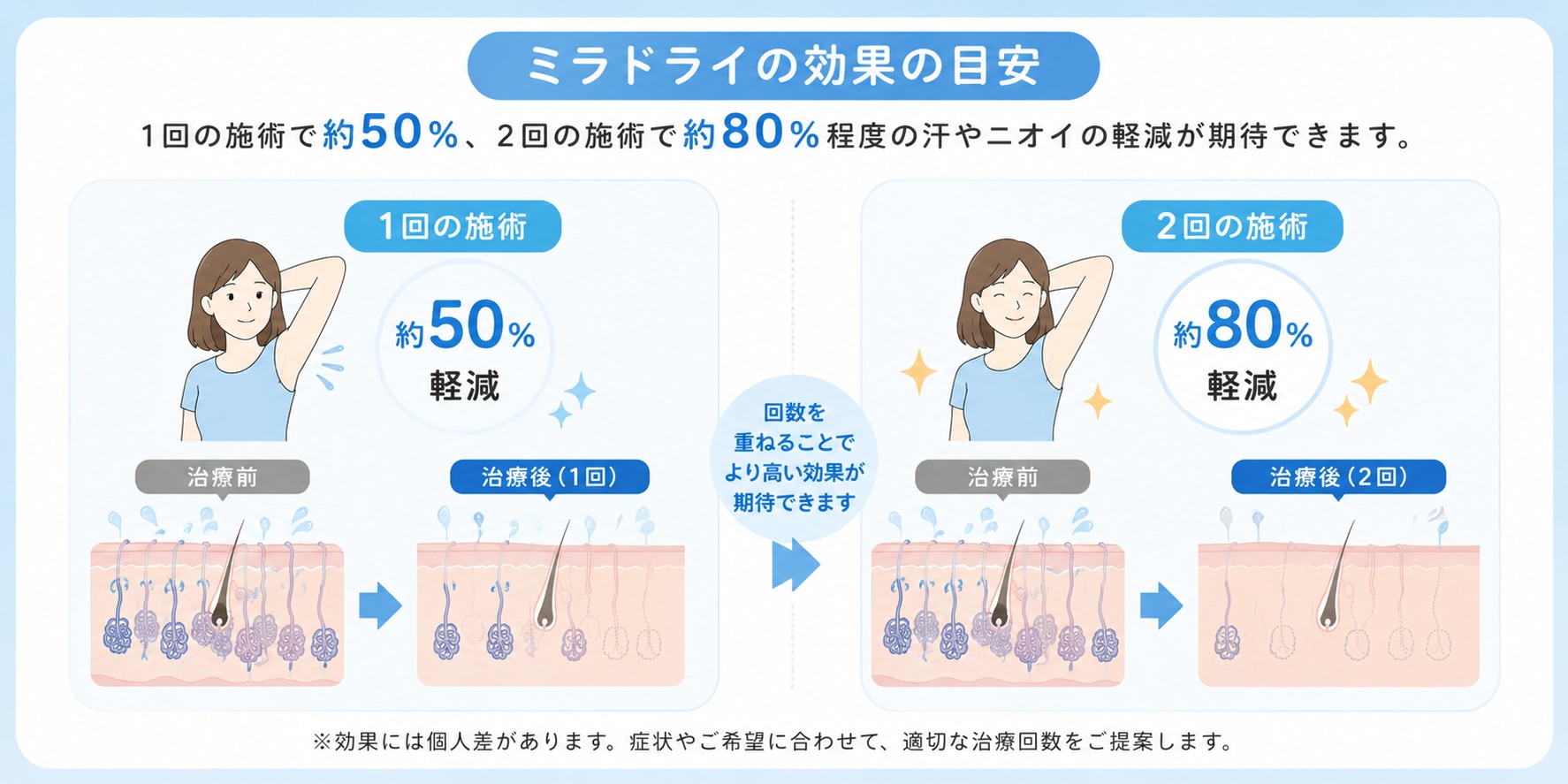 ミラドライは何回受けるべき？効果はいつから実感できる？