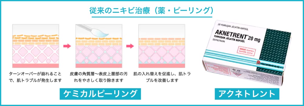従来のニキビ治療（薬・ピーリング）との違い