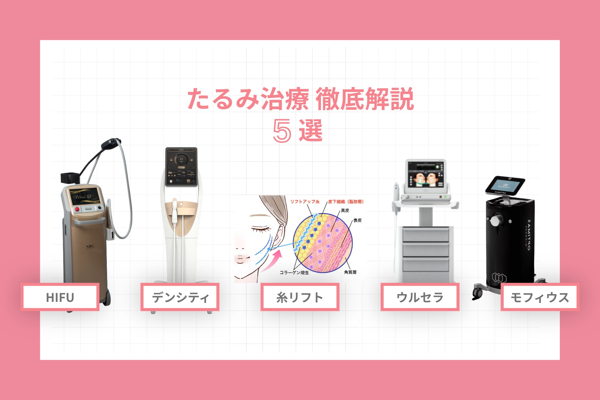 最新版】顔のたるみやほうれい線に効果的な美容医療を徹底比較