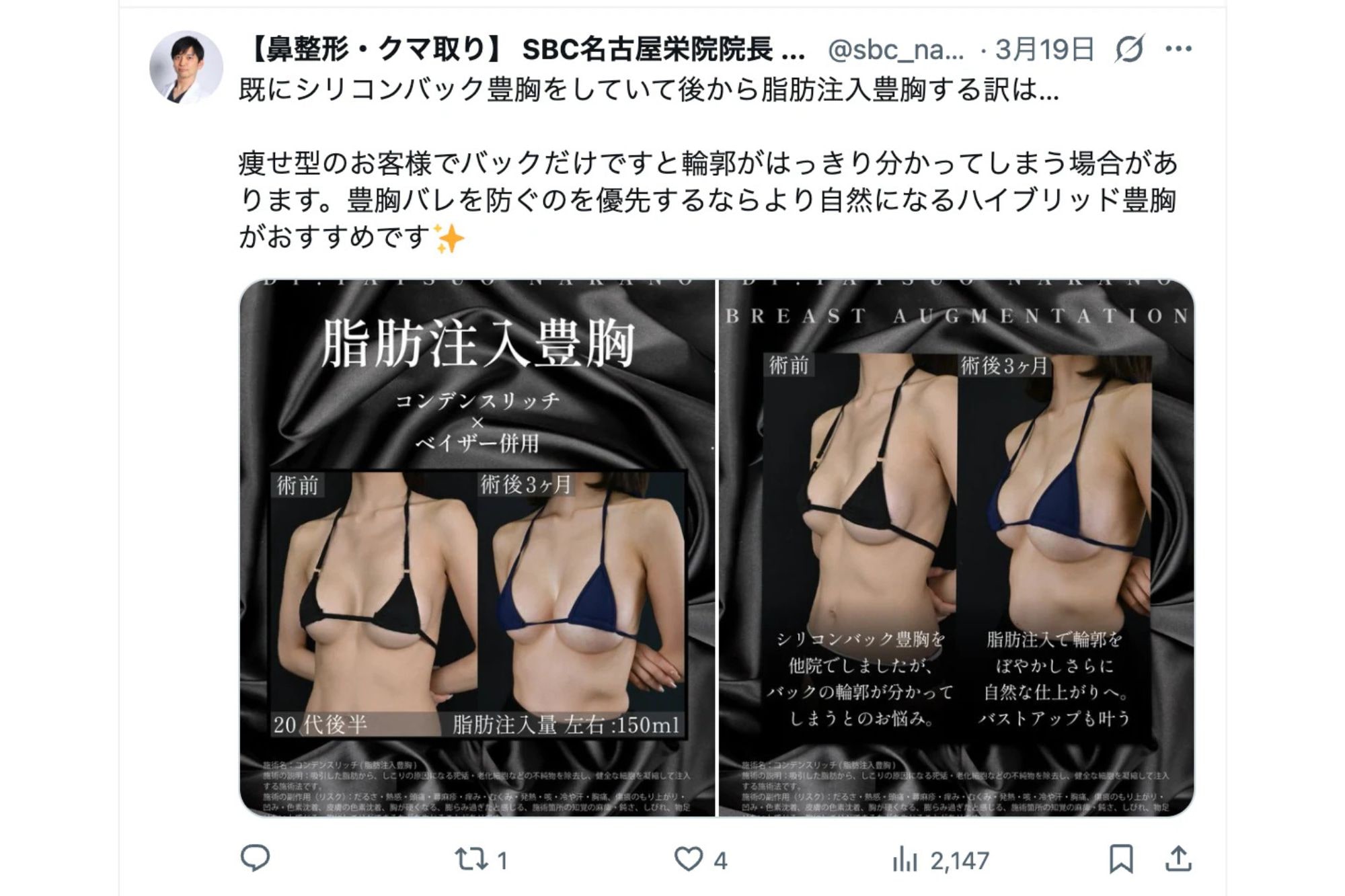 X（旧Twitter）