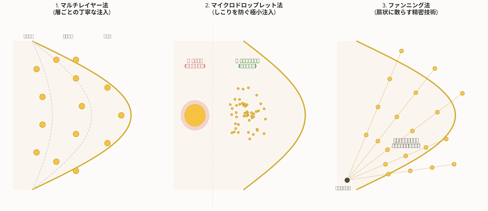 脂肪注入技術