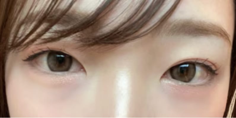 どんな状態？