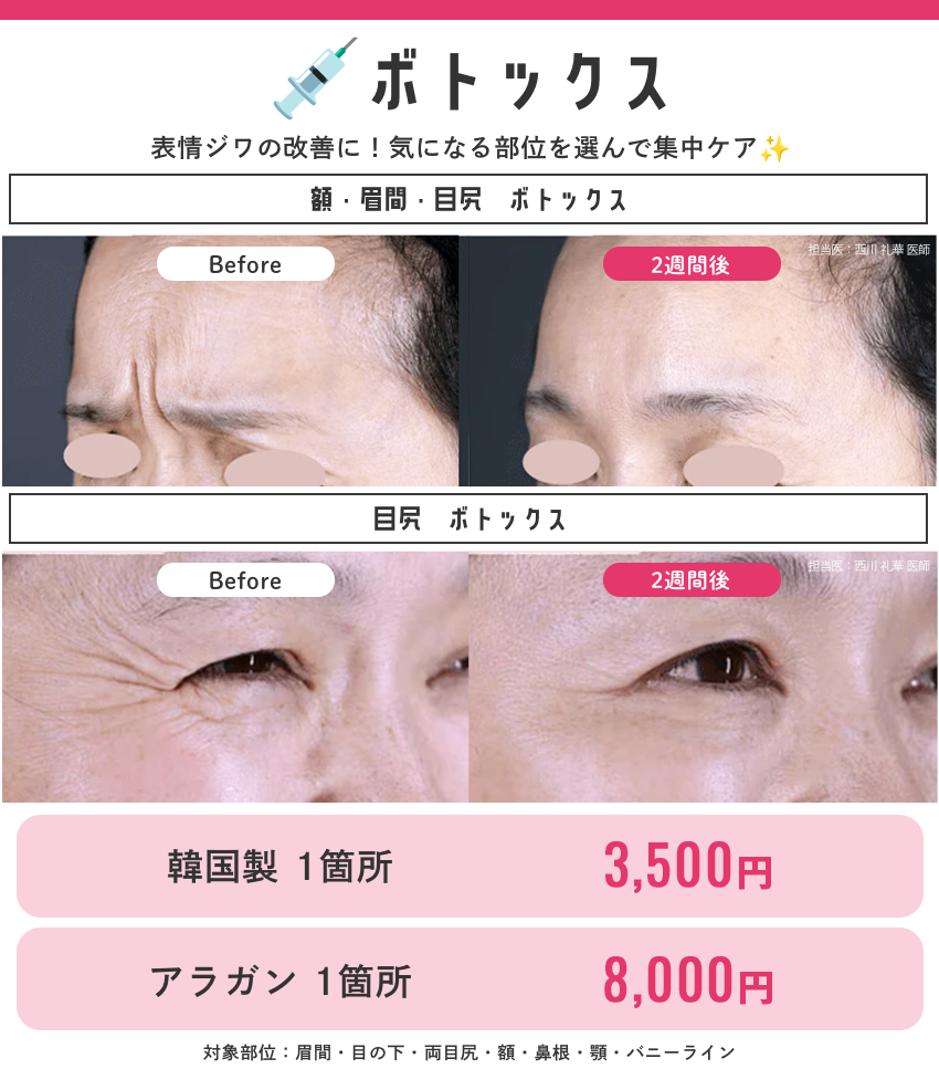 全部¥15,000以内でご紹介💖