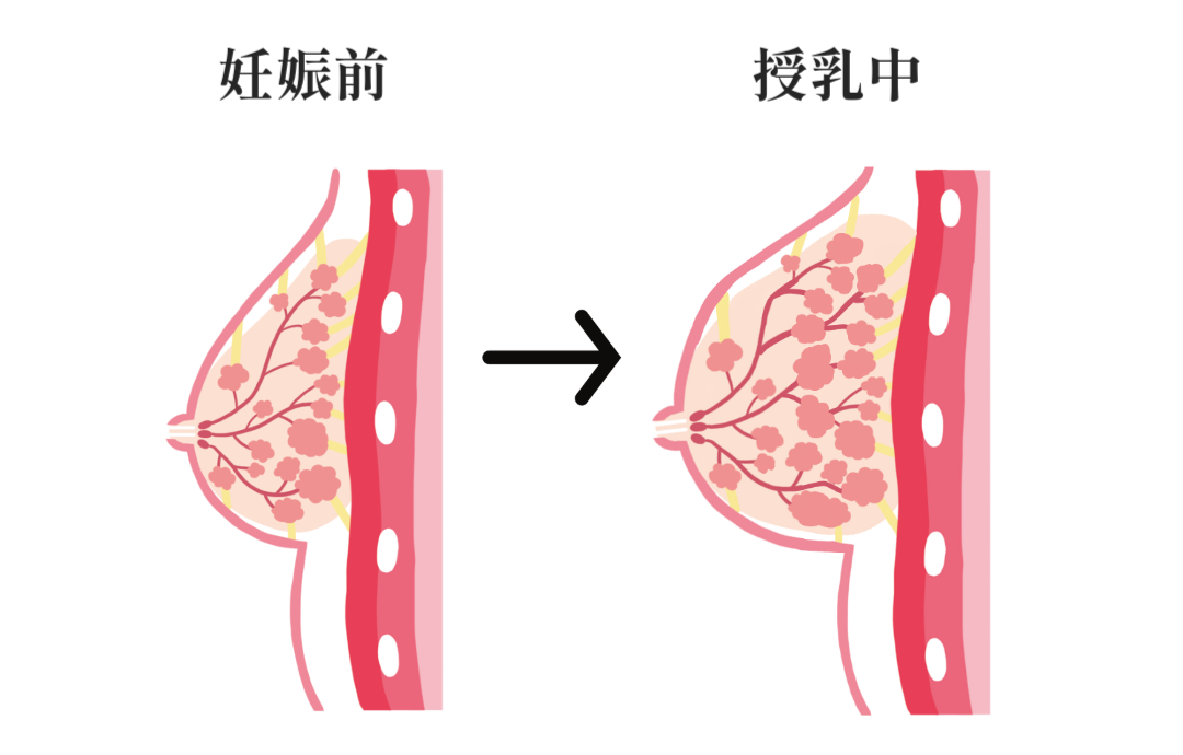 脂肪注入豊胸をしても授乳後に脂肪はなくならない？