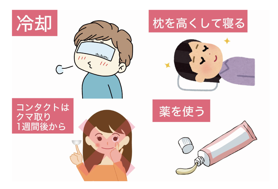 ダウンタイムの過ごし方
