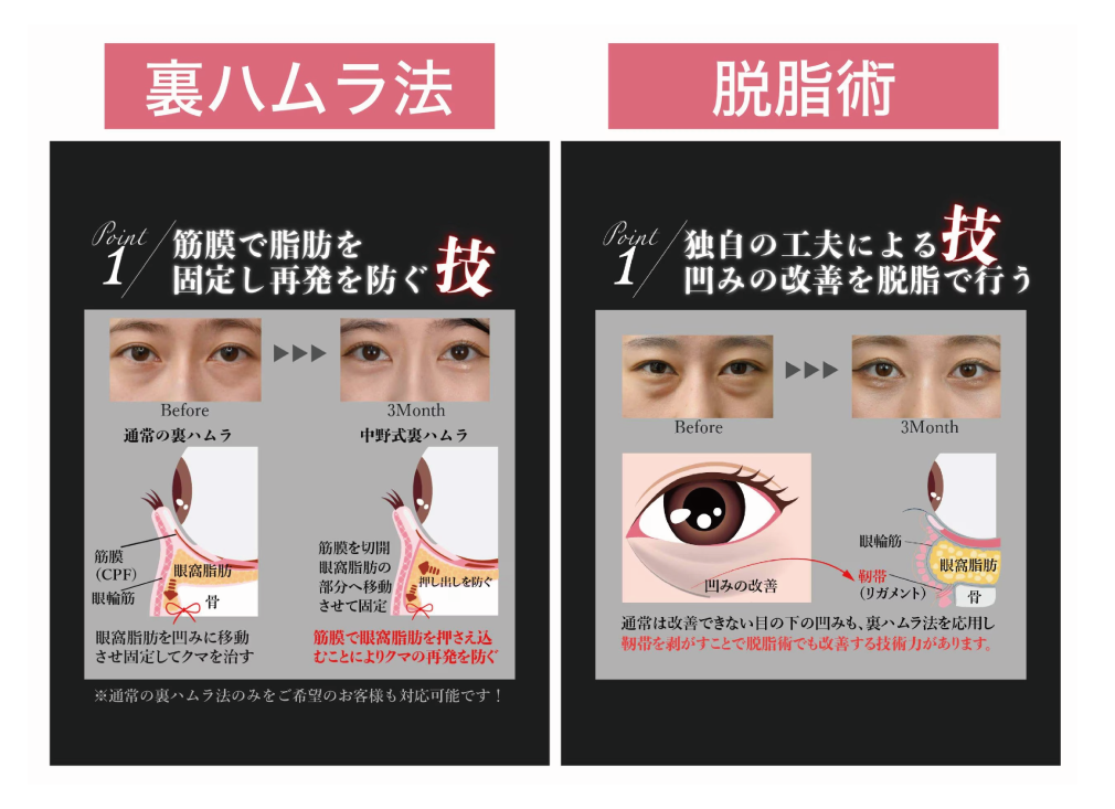 ３つの治療法をご紹介