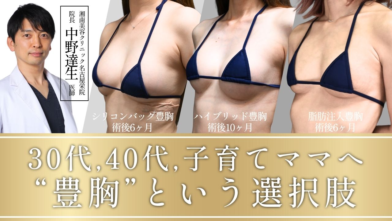 【豊胸症例】授乳後、産後の垂れたバストにアプローチ!ママさんが選ぶ失敗しないママ豊胸