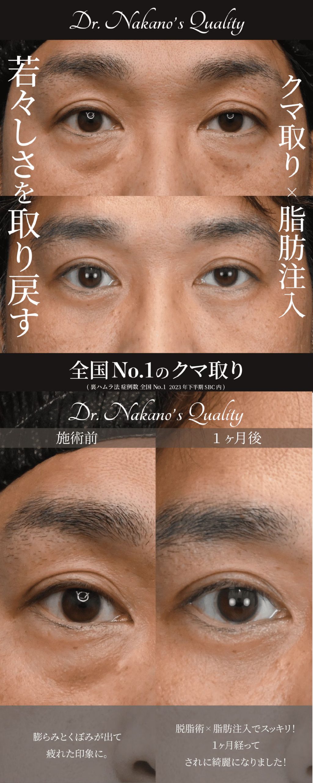 中野医師の脱脂術症例