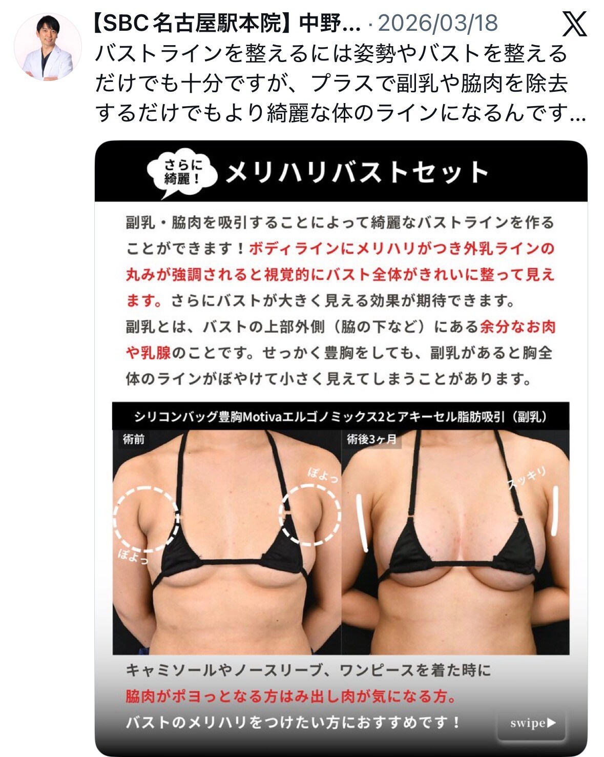 X（旧Twitter）