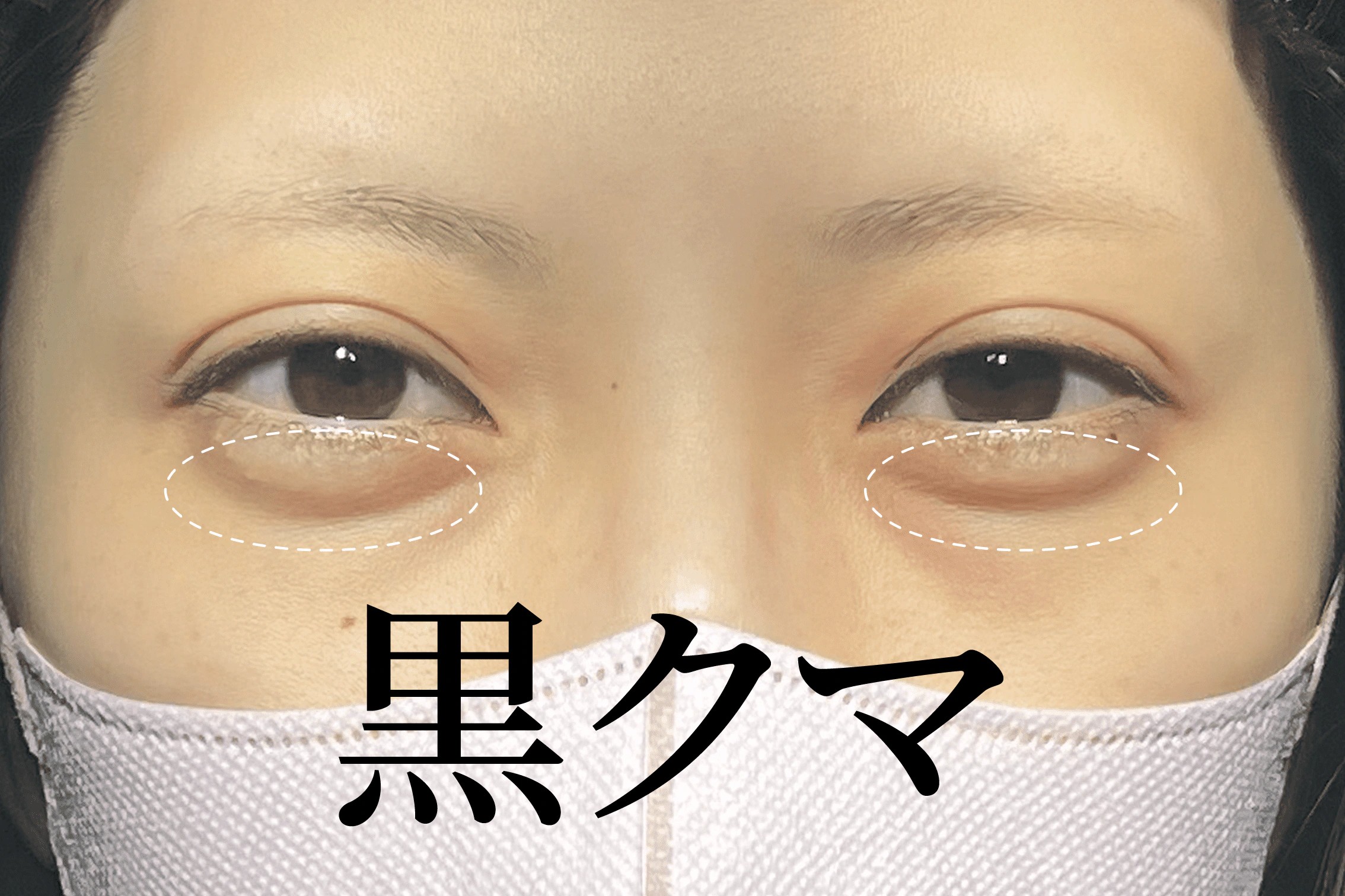 黒熊が気になる場合