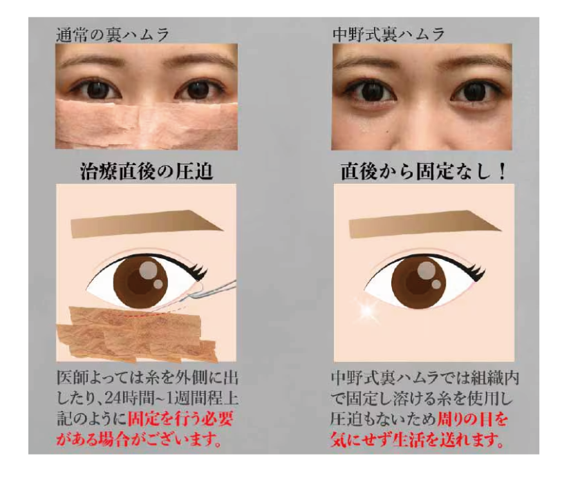 もう一つ利点が！？