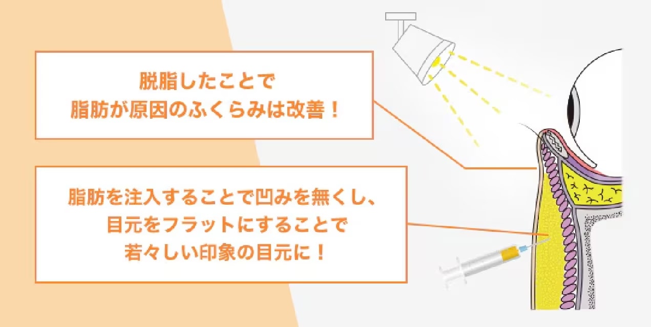 「影をなくす」目元全体の影を改善できる！