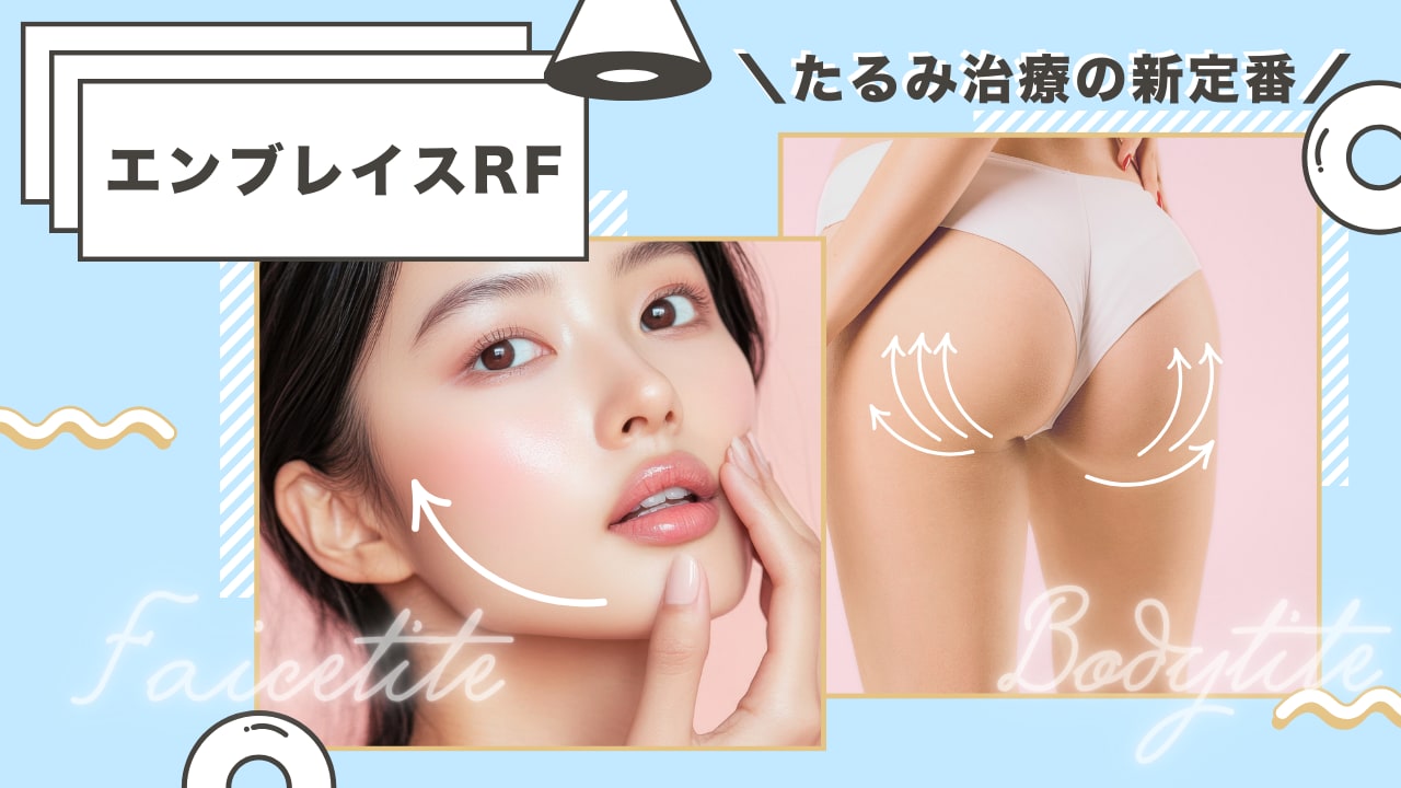 たるみ・リフトアップなら「エンブレイスRF」脂肪吸引後の皮膚の余り対策にも有効！