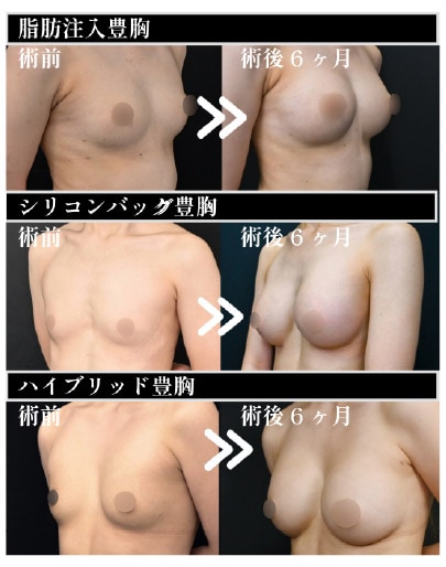 バレないために