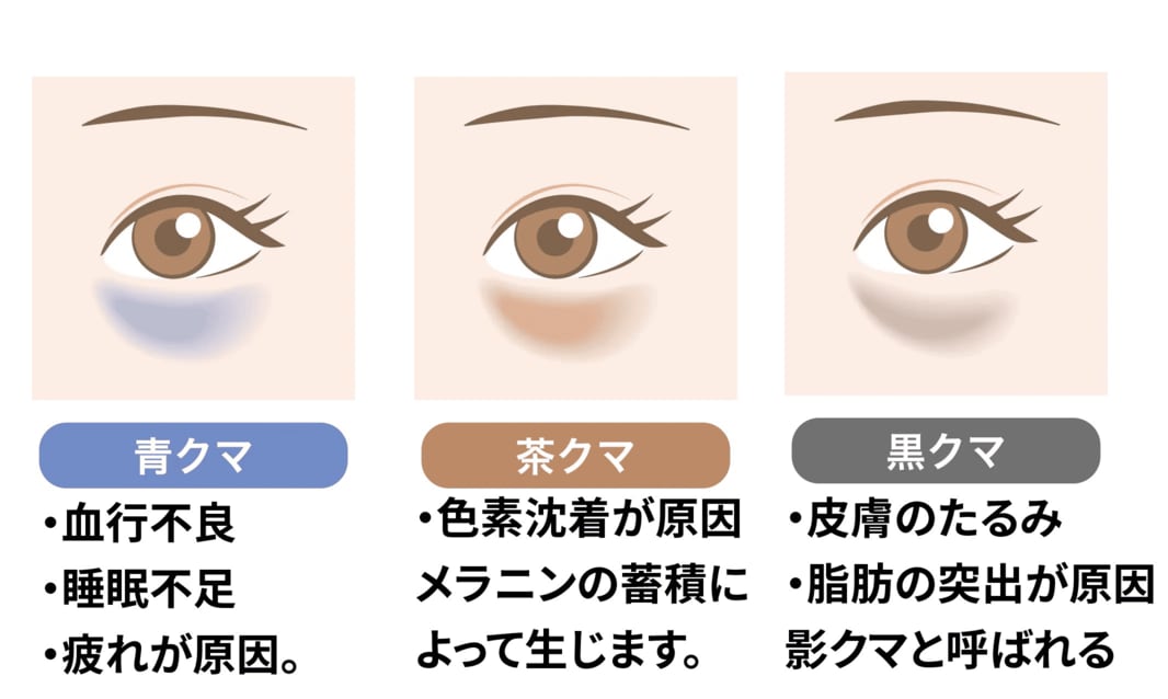 まずは目の下のクマについておさらい