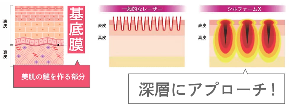 シルファームXはココがすごい❤️‍🔥