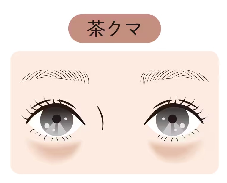 茶クマの場合