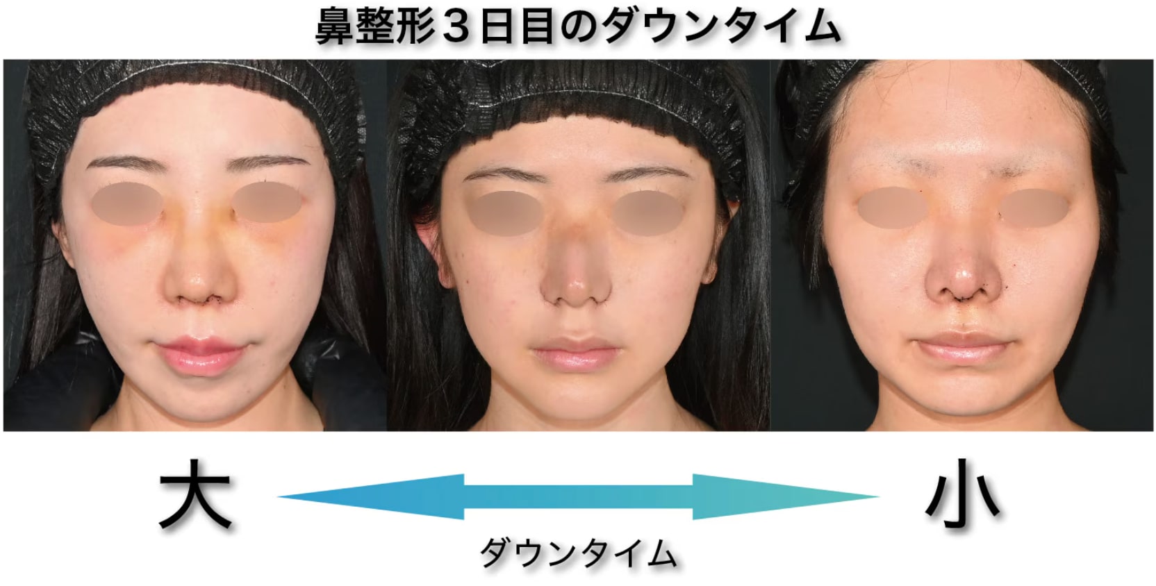個人差はありますがこのような症状が現れます！