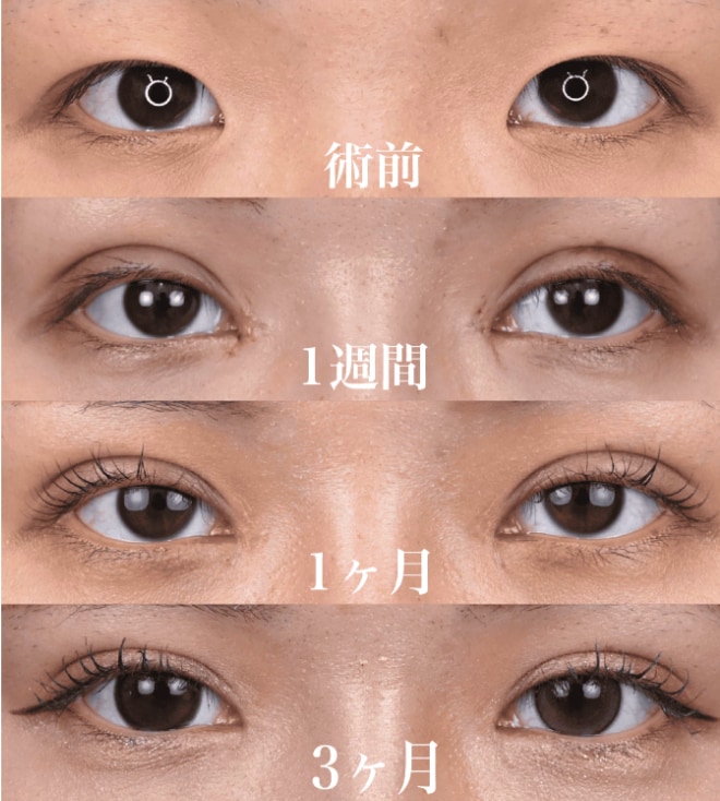10代女性の症例