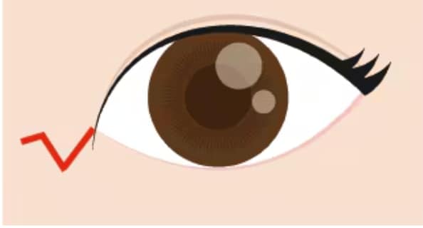 Z法