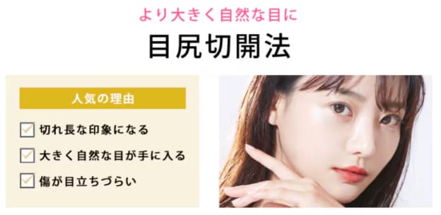 目尻切開とは