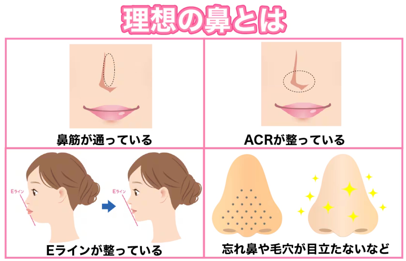 一般的に美しい鼻とはどんな鼻か