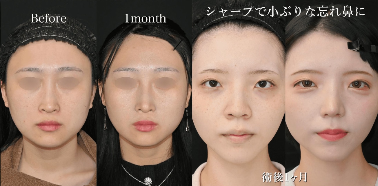 中野医師忘れ鼻をご紹介