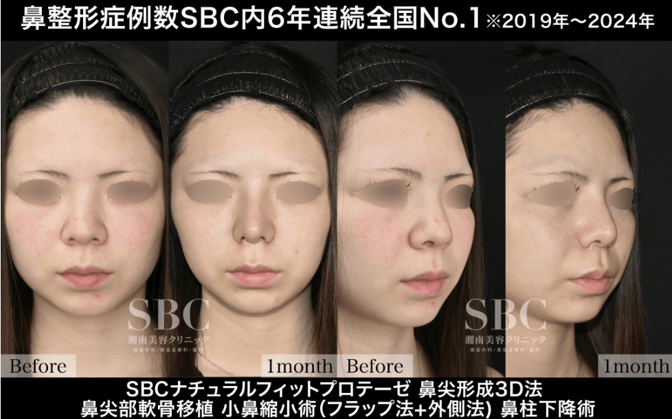 鼻フルで目指す大人気忘れ鼻へ！