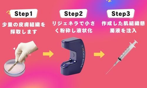 ▼リジェネラの併用をおすすめする施術 ▼