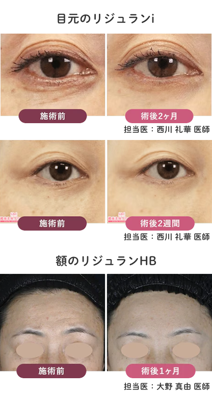 リジュランのご予約