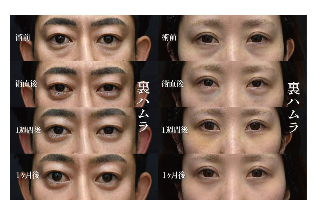 裏ハムラの良いところ