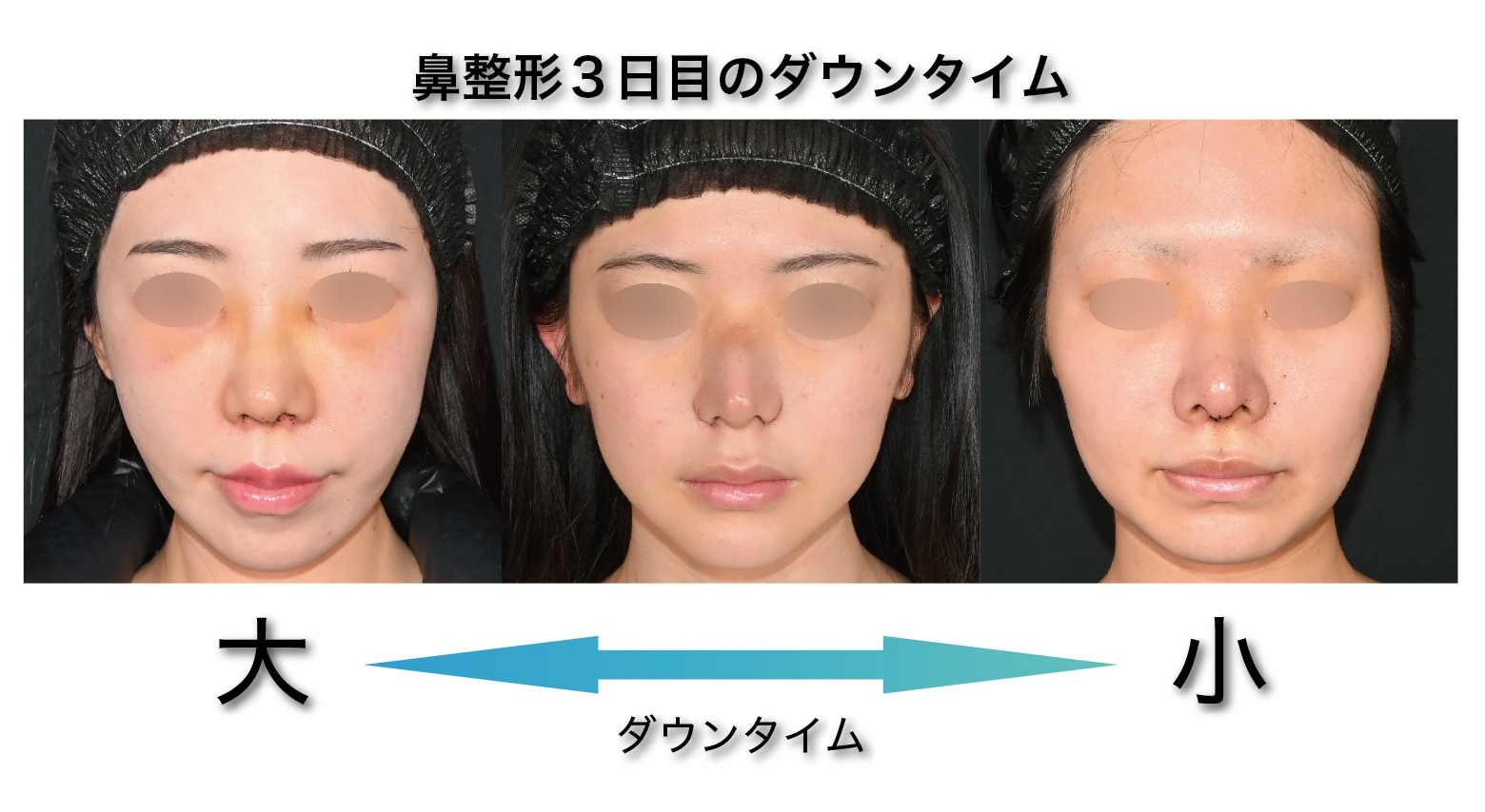 個人差はありますがこのような症状が現れます！