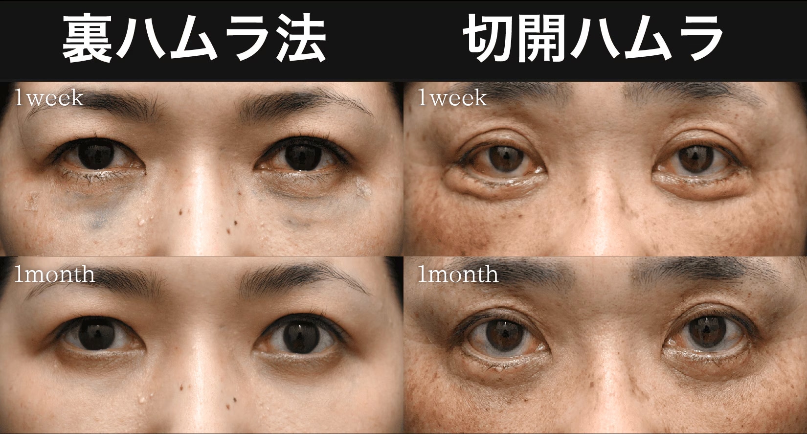 1週間〜1ヶ月までの様子