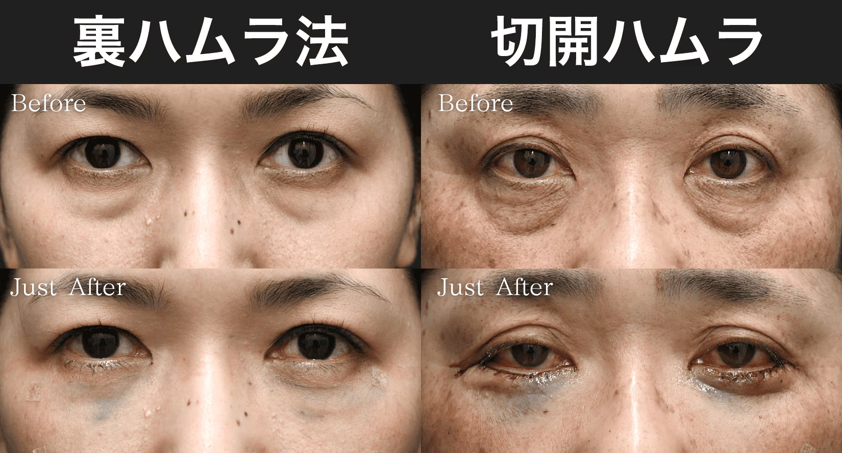施術〜施術直後までの様子