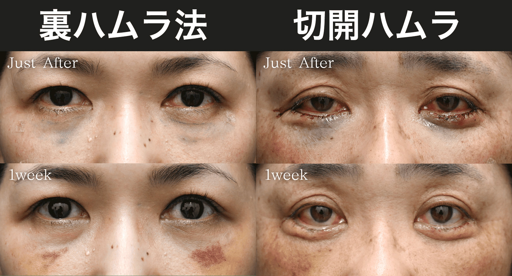 施術直後〜1週間までの様子