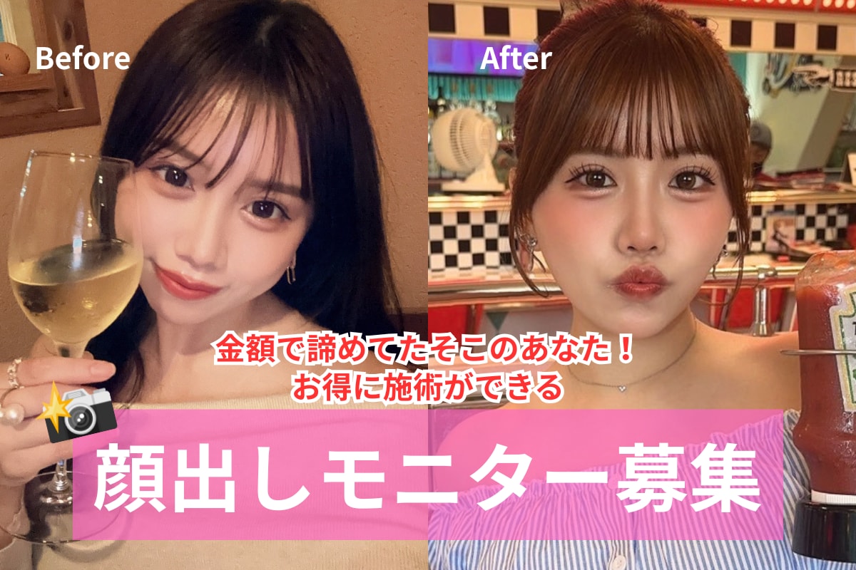 【学生さん必見❗️】中野医師の二重埋没がお得に受けられるチャンス！その条件とは？☀️