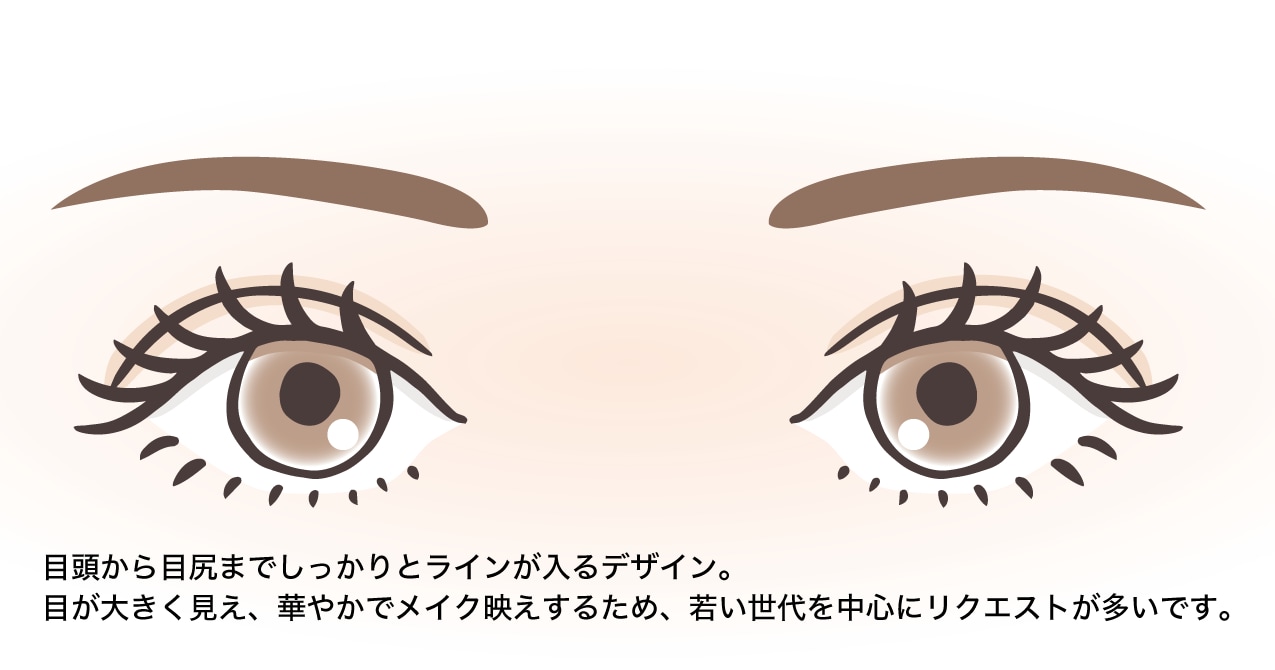 平行型