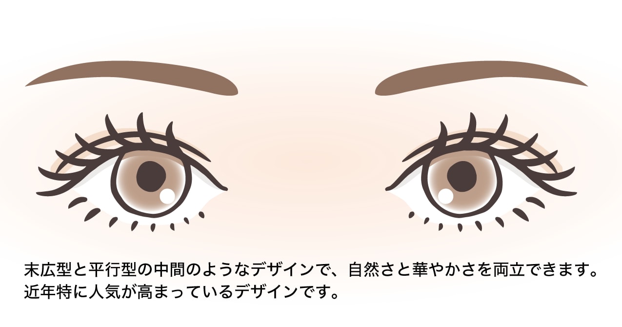 MIX型