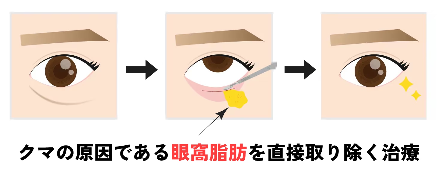ダウンタイムの期間