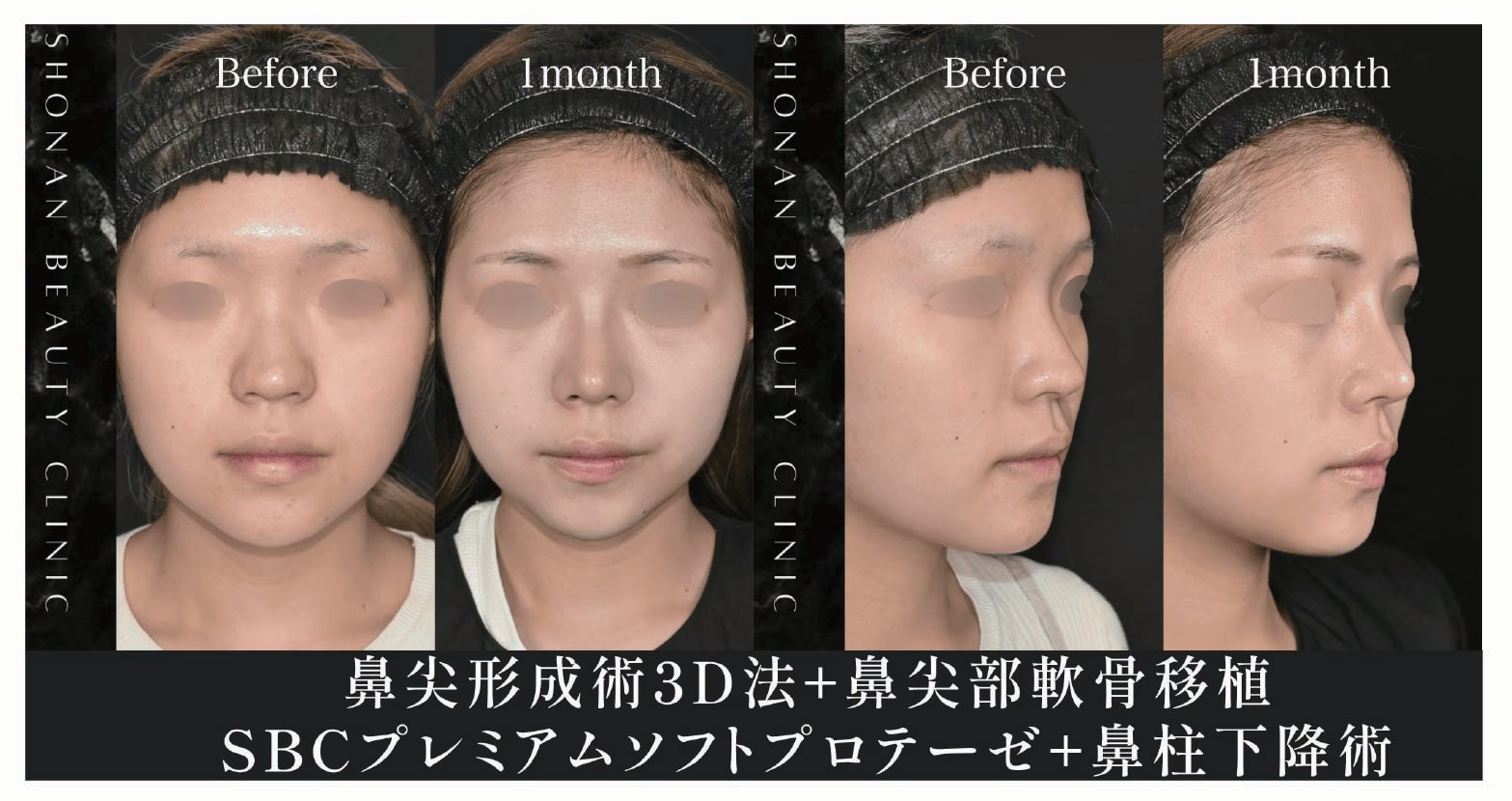 顔全体の調和が取れたバランスの良い鼻