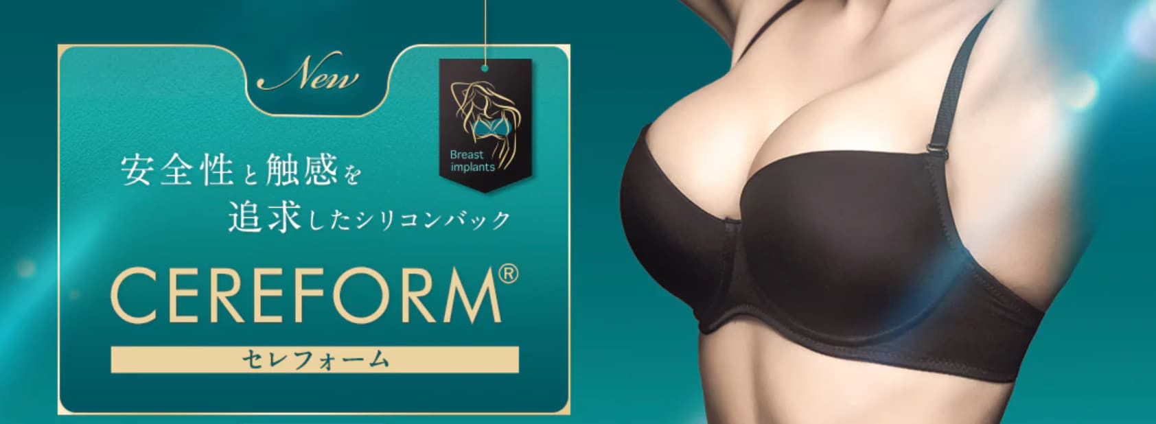 セレフォームの特徴