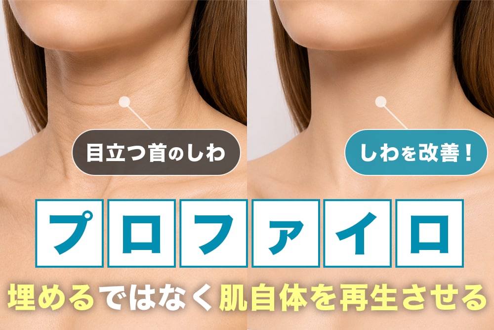 首のしわ改善に効く【プロファイロ】効果・ダウンタイムを徹底解説！｜SBC名古屋駅本院