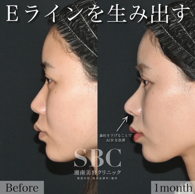 理想の忘れ鼻へ