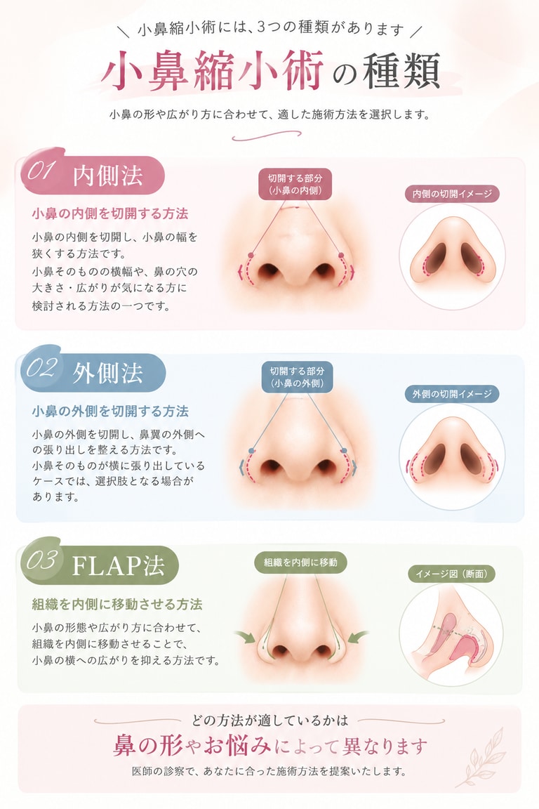 小鼻縮小の治療方法