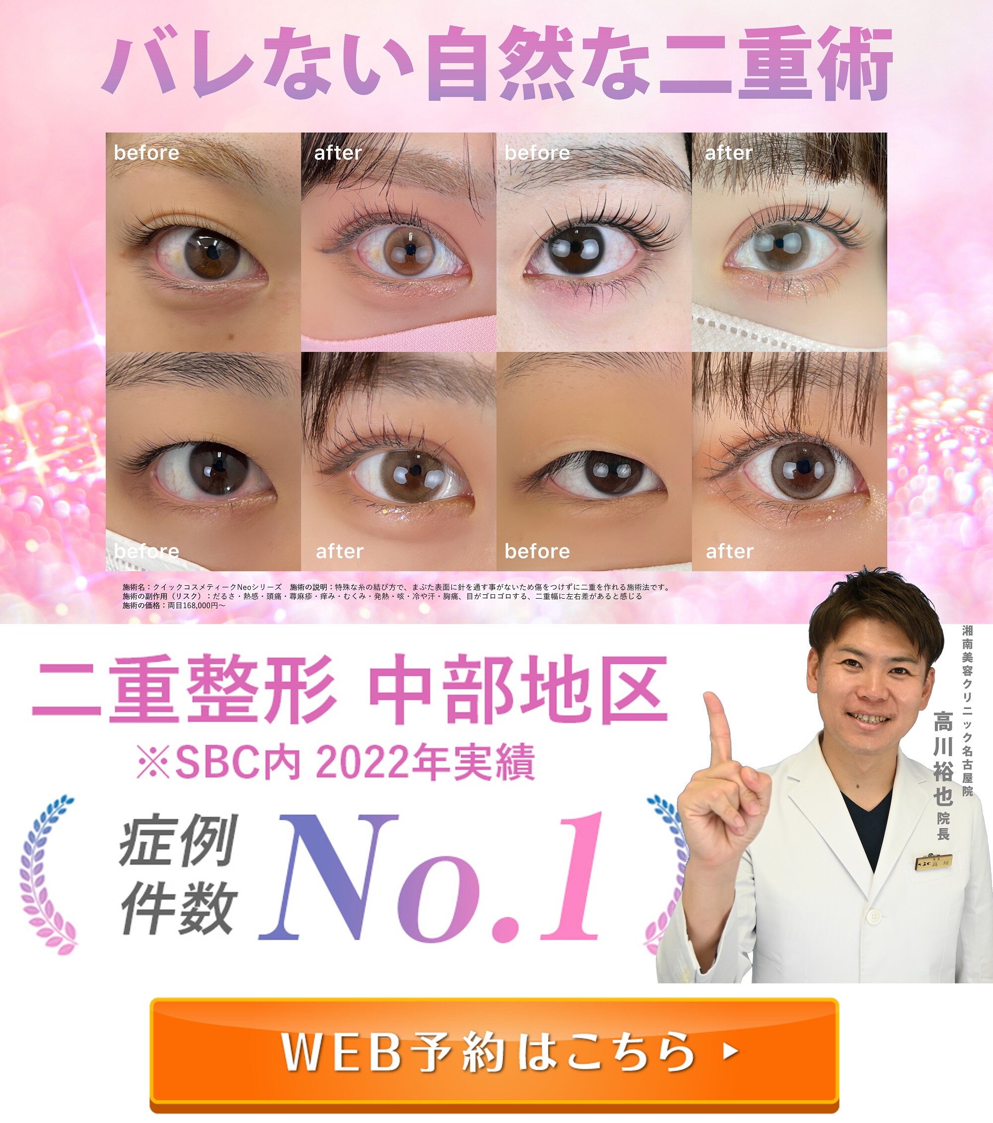 【名古屋の埋没二重】中部地区二重症例数NO.1 半年で1000名以上二重にしている高川裕也先生に任せて安心♪