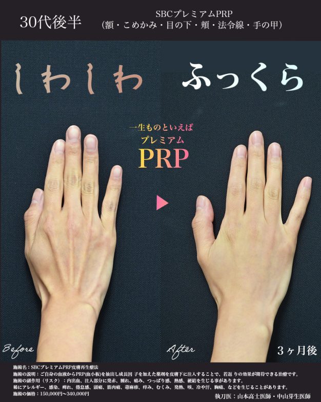 血管の浮き出た手の甲にも効果的です！