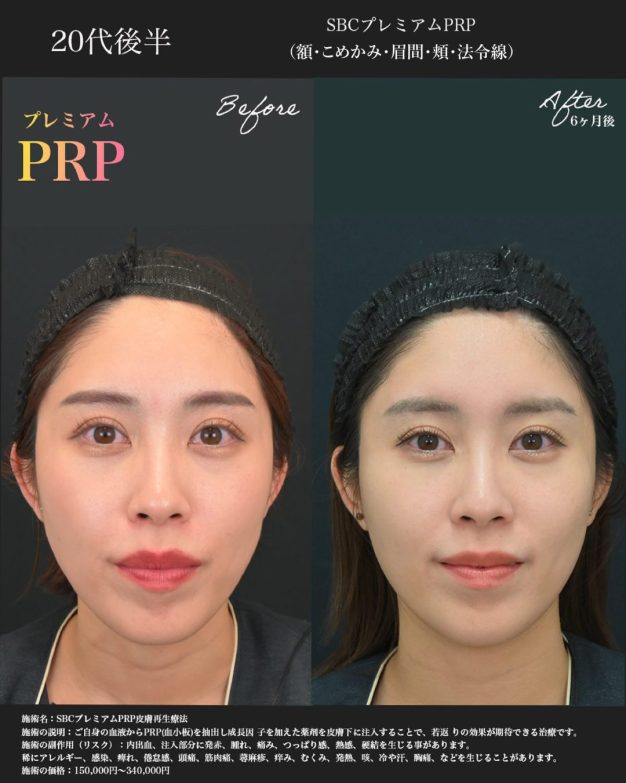 美容知識のある社員が選ぶ若返り治療です
