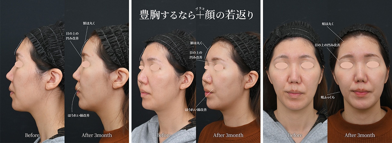 顔や乳首の悩みも一緒に相談できますか？