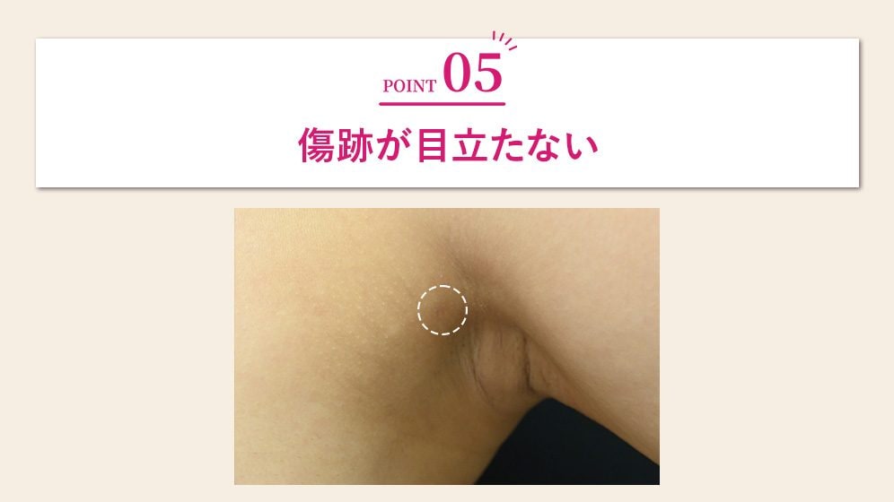 傷跡が目立たない