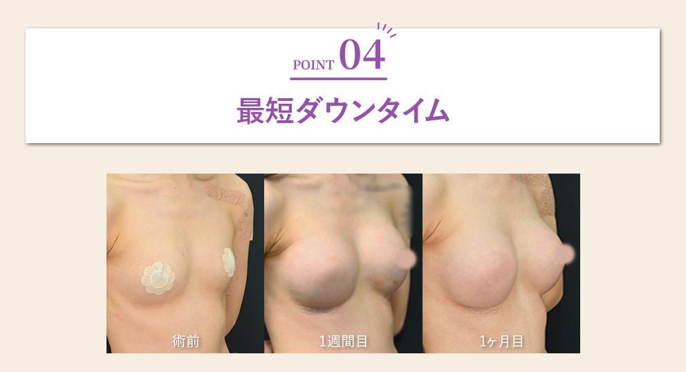最短ダウンタイム